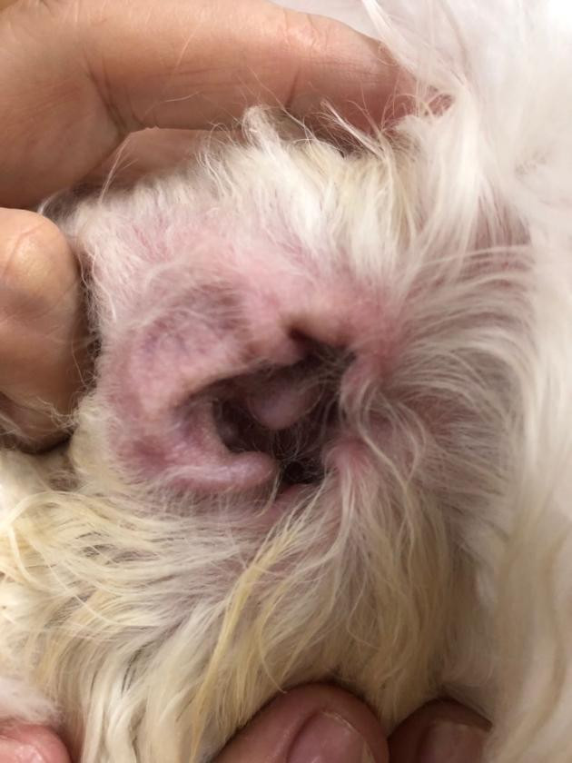 Laser treatment external otitis media Laser treatment external otitis media