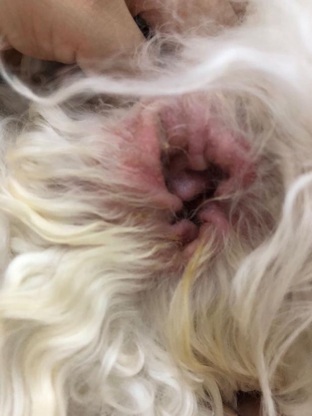 Laser treatment external otitis media Laser treatment external otitis media