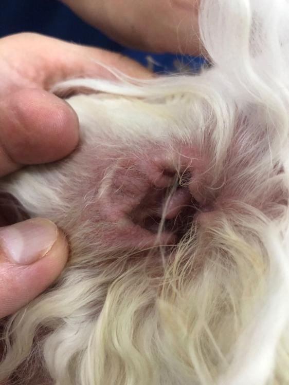 Laser treatment external otitis media Laser treatment external otitis media