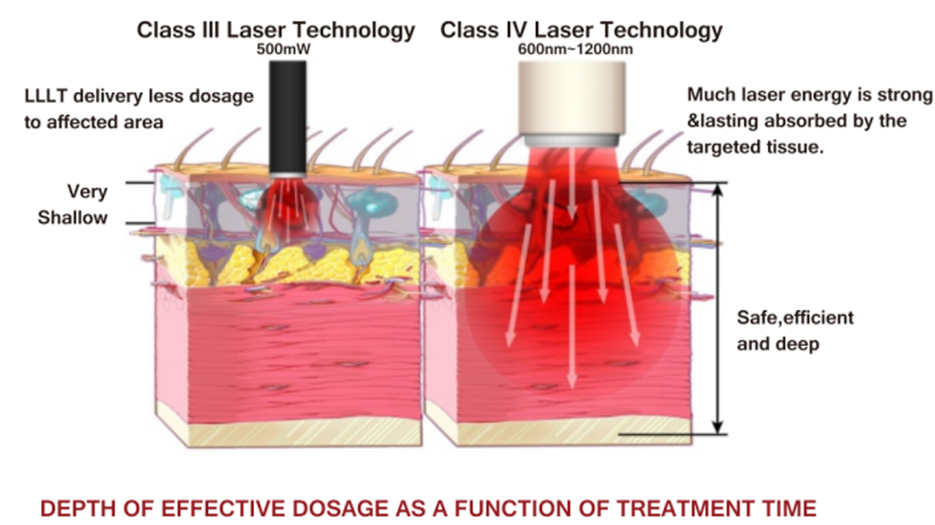 Unleash the Power: Why High-Power Lasers Outshine LLLT